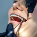 Ortodoncia: transforma tu sonrisa desde la raíz